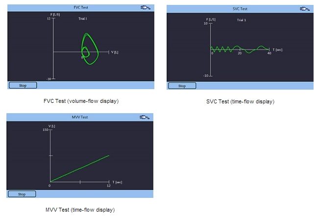 Tests/Measurements