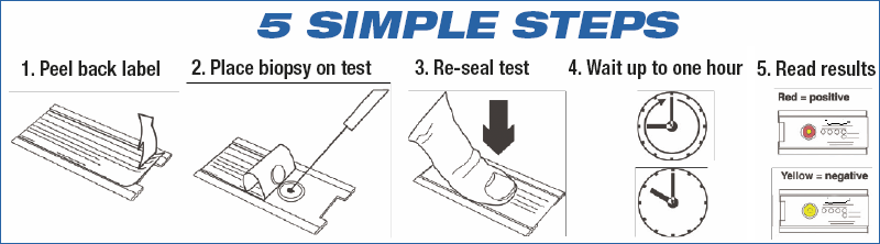 H. Pylori Urease Test